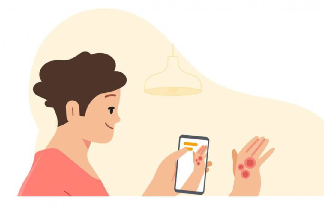 【快訊】Google 推出「皮膚診斷」AI 工具 ３張照片秒知身體問題